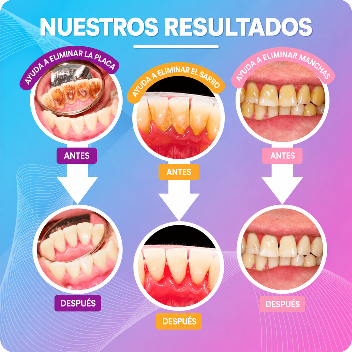 Limpiador ultrasónico de dientes