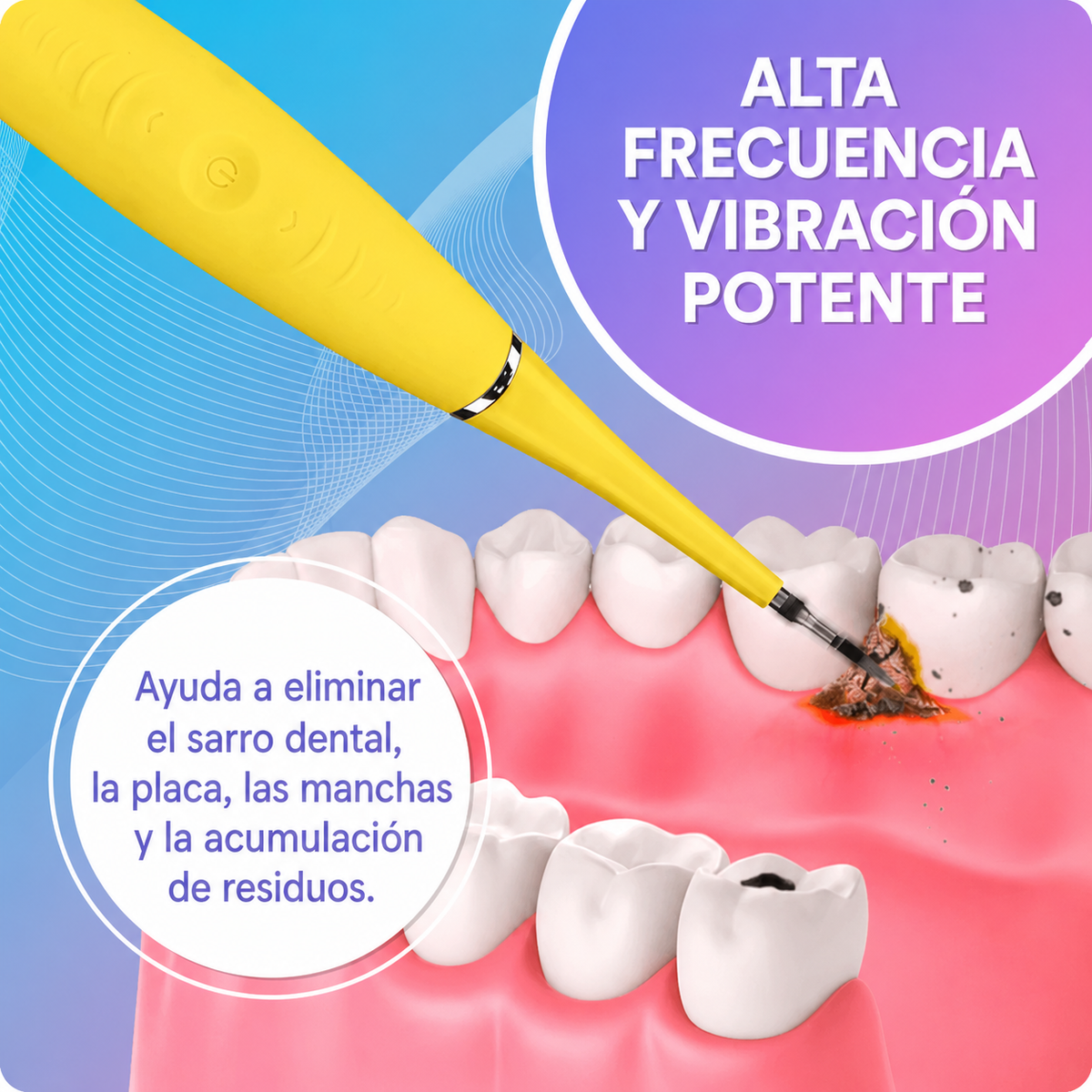 Limpiador ultrasónico de dientes