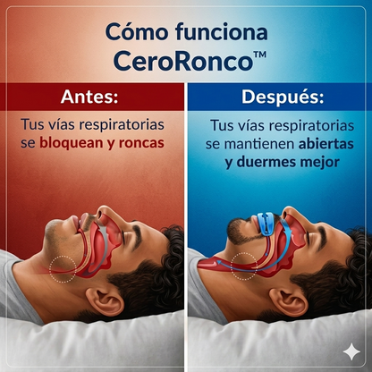 CeroRonco™  boquilla anti-ronquidos